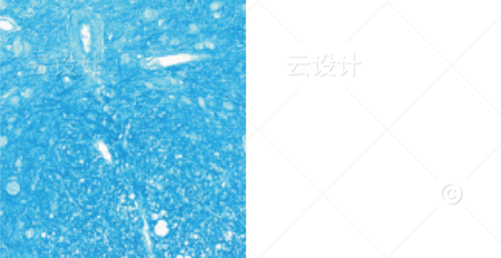 LFB染色